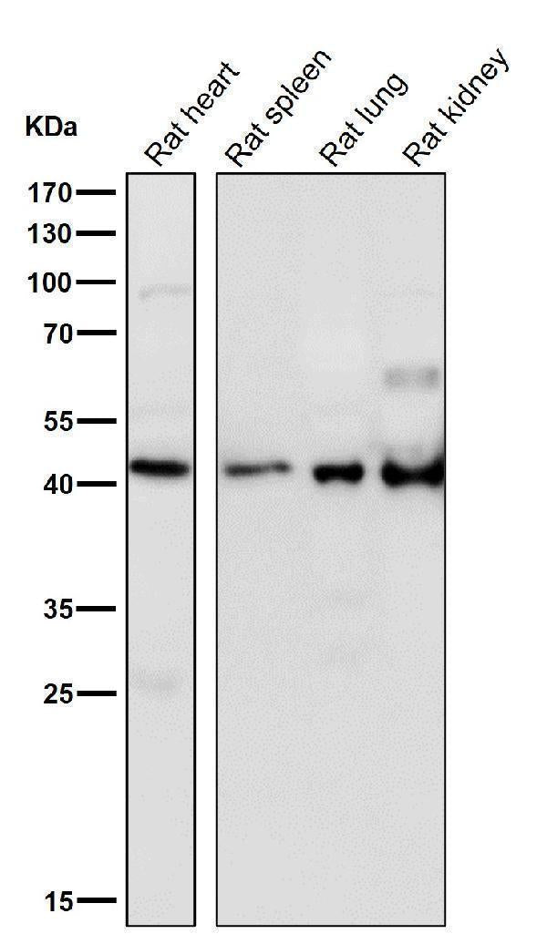 Anti-HOXA5 Rabbit Monoclonal Antibody Boster Bio