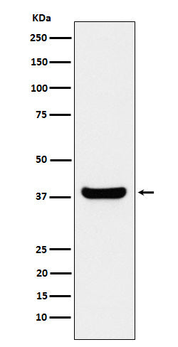 Anti-Protein Phosphatase 1 beta Rabbit Monoclonal Antibody Boster Bio