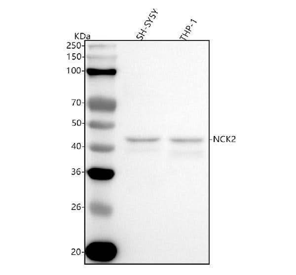 Anti-Nck2 Rabbit Monoclonal Antibody Boster Bio
