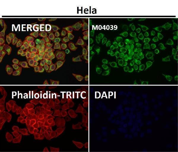 Anti-TOMM20/Tom20 Rabbit Monoclonal Antibody Boster Bio