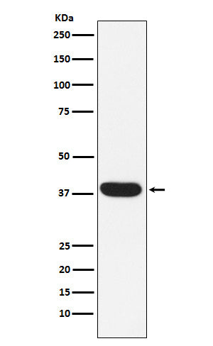 Anti-MYF5 Rabbit Monoclonal Antibody Boster Bio