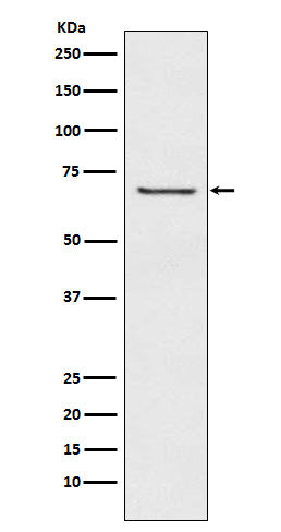 Anti-GABA A Receptor beta 2 Rabbit Monoclonal Antibody Boster Bio
