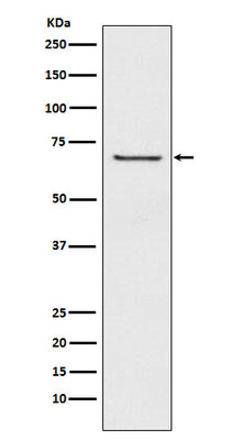 Anti-GABA A Receptor beta 2 Rabbit Monoclonal Antibody Boster Bio