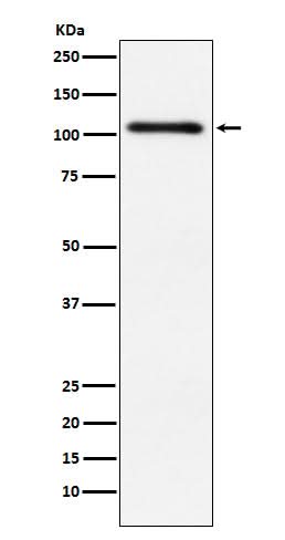 Anti-Protein Kinase D2 Rabbit Monoclonal Antibody Boster Bio