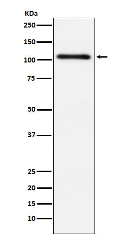 Anti-Protein Kinase D2 Rabbit Monoclonal Antibody Boster Bio