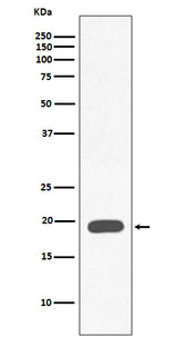 Anti-Myoglobin MB Rabbit Monoclonal Antibody Boster Bio