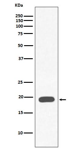 Anti-Myoglobin MB Rabbit Monoclonal Antibody Boster Bio