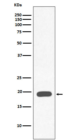 Anti-Myoglobin MB Rabbit Monoclonal Antibody Boster Bio