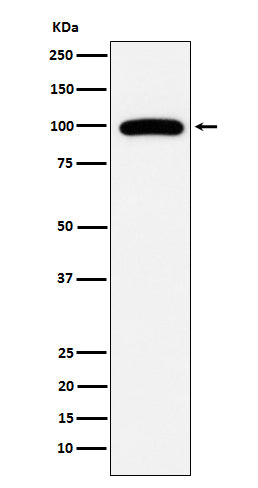 Anti-CD10 MME Monoclonal Antibody Boster Bio