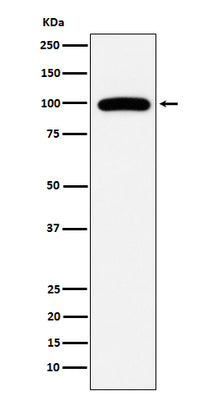 Anti-CD10 MME Monoclonal Antibody Boster Bio