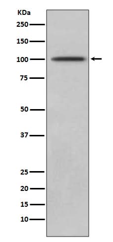 Anti-CD10 MME Rabbit Monoclonal Antibody Boster Bio