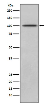 Anti-CD10 MME Rabbit Monoclonal Antibody Boster Bio