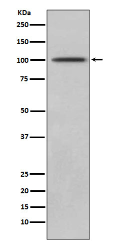 Anti-CD10 MME Rabbit Monoclonal Antibody Boster Bio