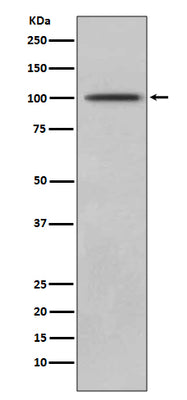 Anti-CD10 MME Rabbit Monoclonal Antibody Boster Bio