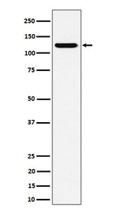 Anti-PKN2 Rabbit Monoclonal Antibody Boster Bio