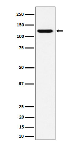 Anti-PKN2 Rabbit Monoclonal Antibody Boster Bio