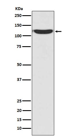 Anti-PKN2/Prk2 Rabbit Monoclonal Antibody Boster Bio