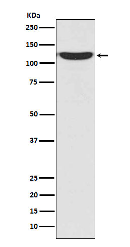 Anti-PKN2/Prk2 Rabbit Monoclonal Antibody Boster Bio