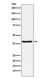 Anti-SerpinB3 Rabbit Monoclonal Antibody Boster Bio