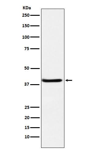 Anti-SerpinB3 Rabbit Monoclonal Antibody Boster Bio