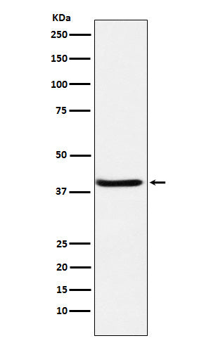 Anti-SerpinB3 Rabbit Monoclonal Antibody Boster Bio