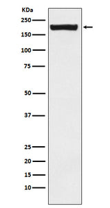 Anti-MRC2/ENDO180 Rabbit Monoclonal Antibody Boster Bio