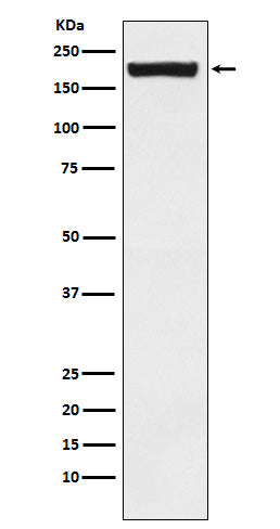 Anti-MRC2/ENDO180 Rabbit Monoclonal Antibody Boster Bio