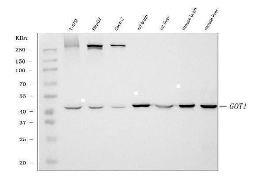 Anti-Aspartate Aminotransferase/GOT1 Antibody Picoband® (monoclonal, 6B3B4 Boster Bio
