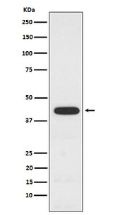 Anti-PCYT1A Rabbit Monoclonal Antibody Boster Bio