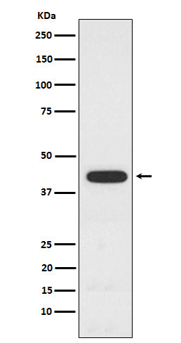 Anti-PCYT1A Rabbit Monoclonal Antibody Boster Bio