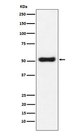 Anti-OLFM4 Monoclonal Antibody Boster Bio