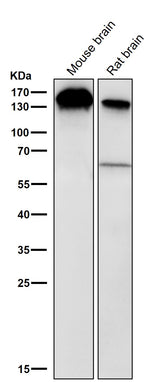 Anti-BTF Rabbit Monoclonal Antibody Boster Bio