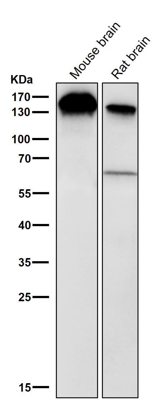 Anti-BTF Rabbit Monoclonal Antibody Boster Bio