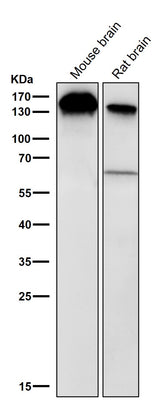 Anti-BTF Rabbit Monoclonal Antibody Boster Bio