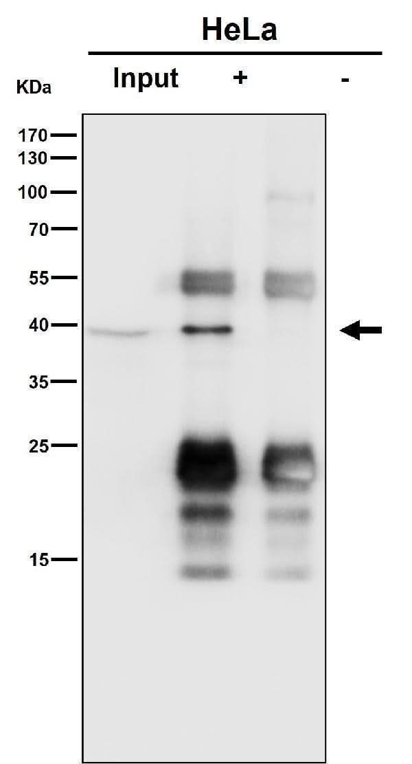 Anti-SLP2 Rabbit Monoclonal Antibody Boster Bio