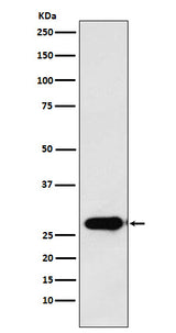 Anti-Calpain S1 Rabbit Monoclonal Antibody Boster Bio