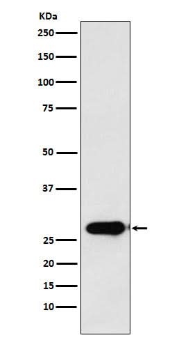 Anti-Calpain S1 Rabbit Monoclonal Antibody Boster Bio