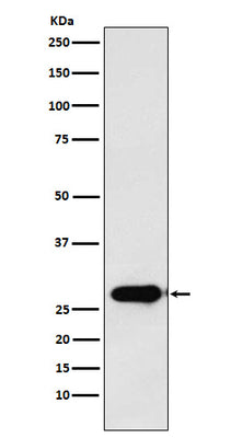 Anti-Calpain S1 Rabbit Monoclonal Antibody Boster Bio