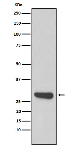 Anti-Calpain small subunit 1 Rabbit Monoclonal Antibody Boster Bio