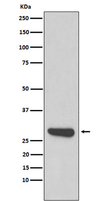 Anti-Calpain small subunit 1 Rabbit Monoclonal Antibody Boster Bio