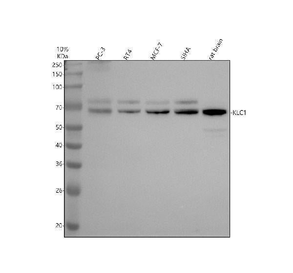 Anti-KLC1 Rabbit Monoclonal Antibody Boster Bio
