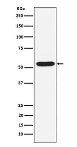 Anti-PIAS2 Rabbit Monoclonal Antibody Boster Bio