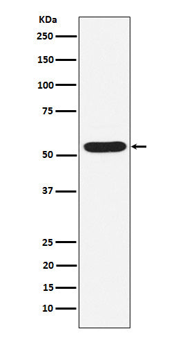 Anti-PIAS2 Rabbit Monoclonal Antibody Boster Bio