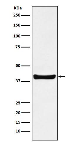 Anti-p40 Rabbit Monoclonal Antibody Boster Bio
