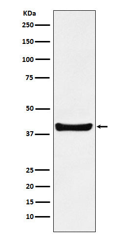 Anti-p40 Rabbit Monoclonal Antibody Boster Bio