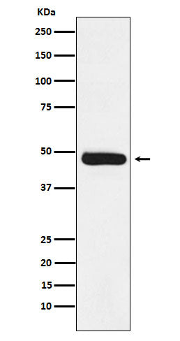 Anti-ERCC8 Rabbit Monoclonal Antibody Boster Bio