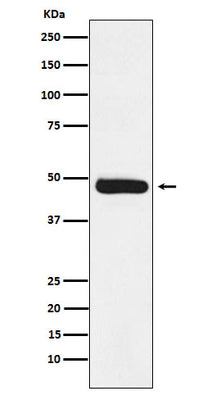 Anti-ERCC8 Rabbit Monoclonal Antibody Boster Bio