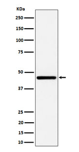 Anti-GNA13 Rabbit Monoclonal Antibody Boster Bio