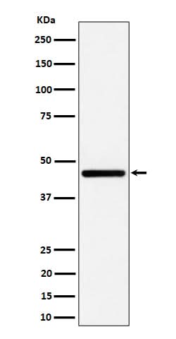 Anti-GNA13 Rabbit Monoclonal Antibody Boster Bio