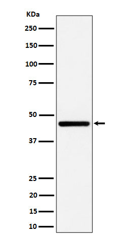 Anti-GNA13 Rabbit Monoclonal Antibody Boster Bio